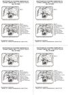 Фото Подкрылок CITROEN Jumper 2006- с расширителями арок (передний левый) / Ситроен Джампер Autofamily NLL1018001 Autofamily