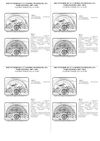 Фото Подкрылок FORD Mondeo, 2007-2014, седан (задний левый) / Форд Мондео Autofamily NLL1618003 Autofamily